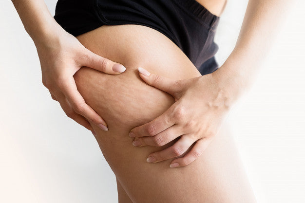 How to get rid of Cellulite!